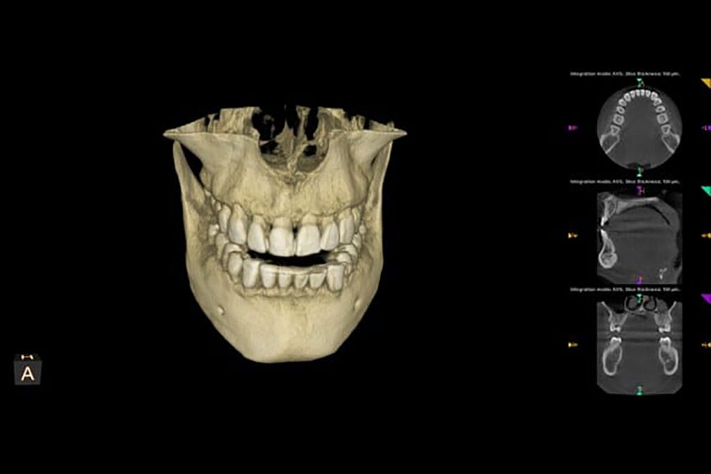 3D dental scan of the upper and lower jaw with teeth, plus cross-sectional views of the jawbone on the right side, displayed on a black background—ideal for oral health assessment and advanced dental diagnostic services.