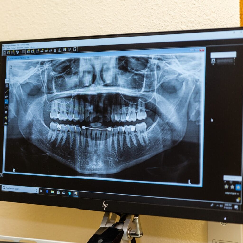 A computer monitor displays a dental X-ray image showing a full set of adult teeth, including upper and lower jaws, with details of teeth alignment and jaw structure visible.