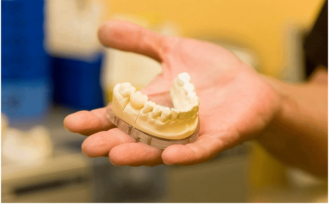 A person holds a dental model showing upper and lower teeth, likely used for oral health demonstrations or dental diagnostic services.