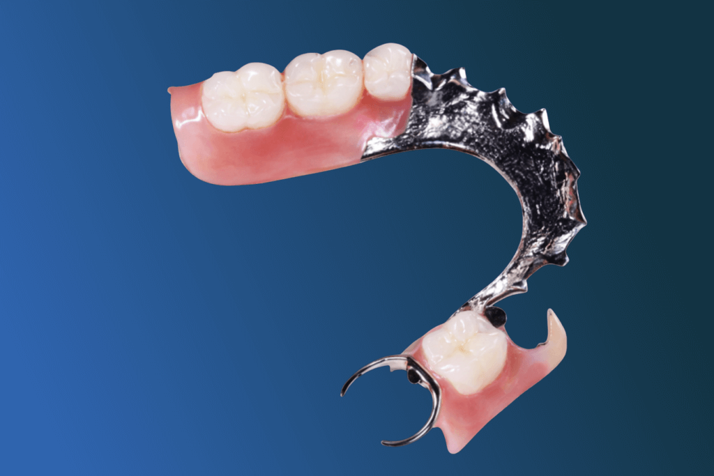 A partial denture with pink gum-colored acrylic, white artificial teeth, and a metal framework and clasp, shown against a blue gradient background.