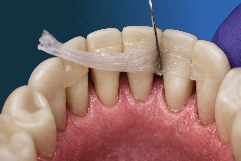 Close-up of dental model showing a dental floss being threaded between two lower front teeth, with a gloved hand holding the floss to demonstrate proper preventive services and correct flossing technique.